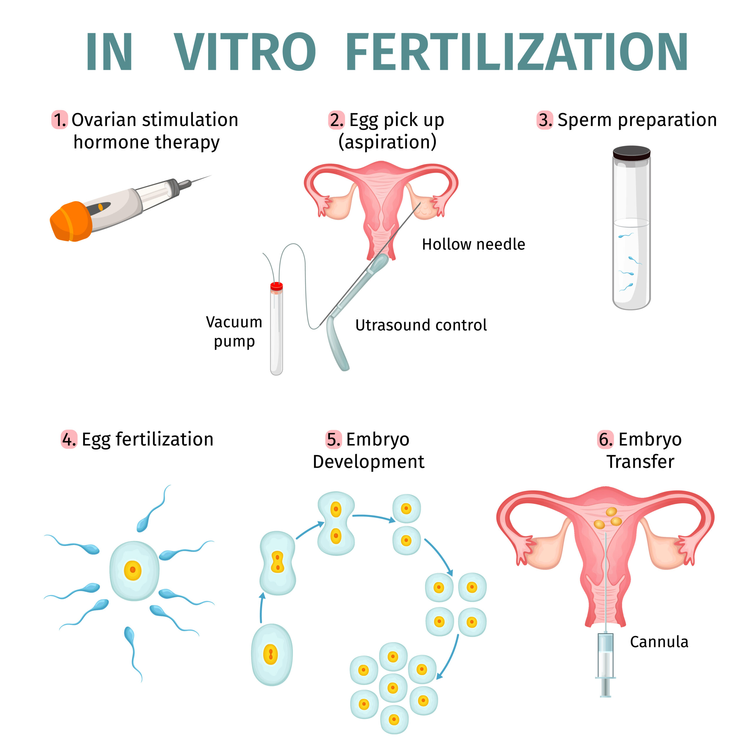 A Guide To In Vitro Fertilization Ivf 7909
