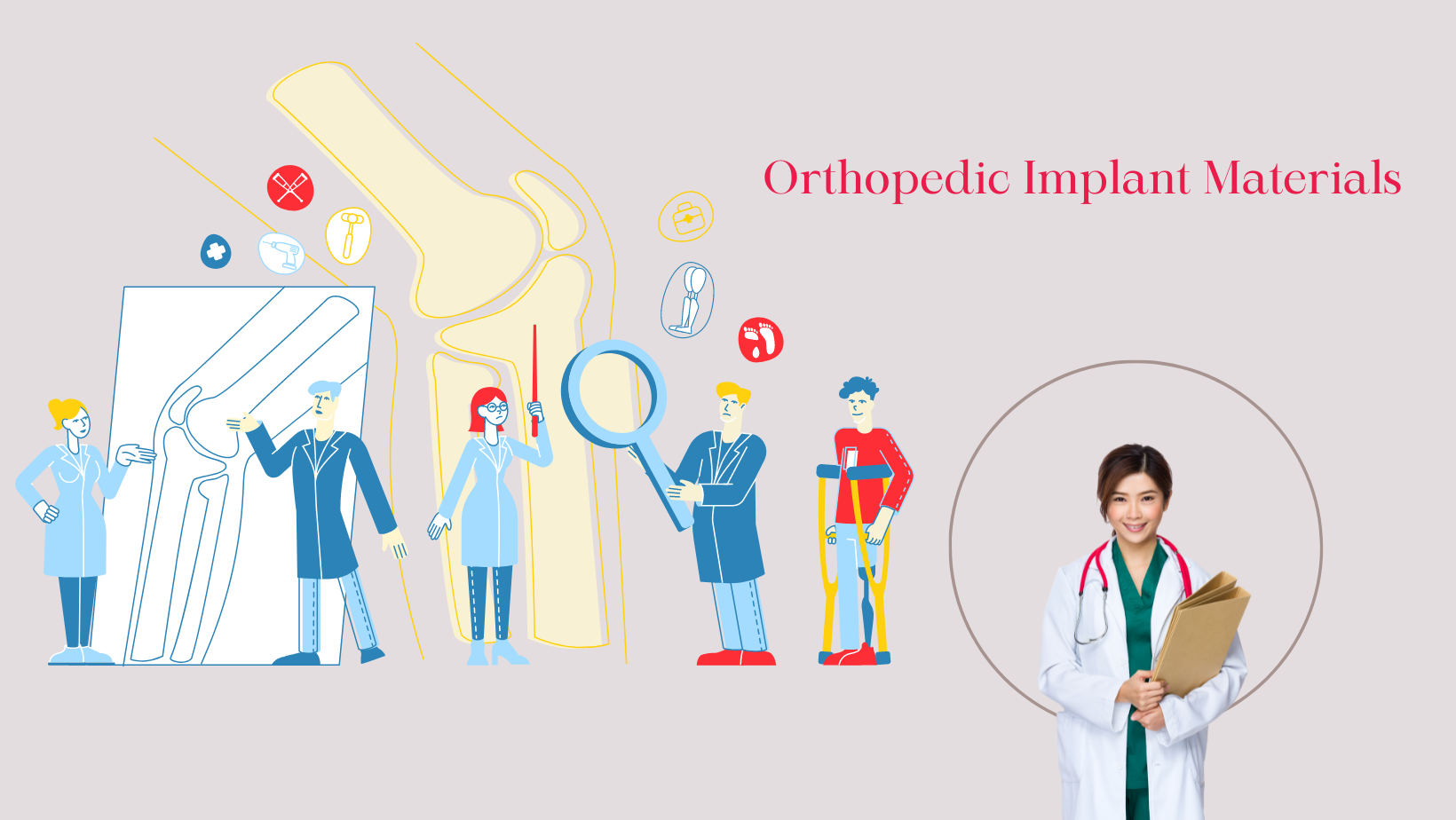 Orthopedic Implant Materials