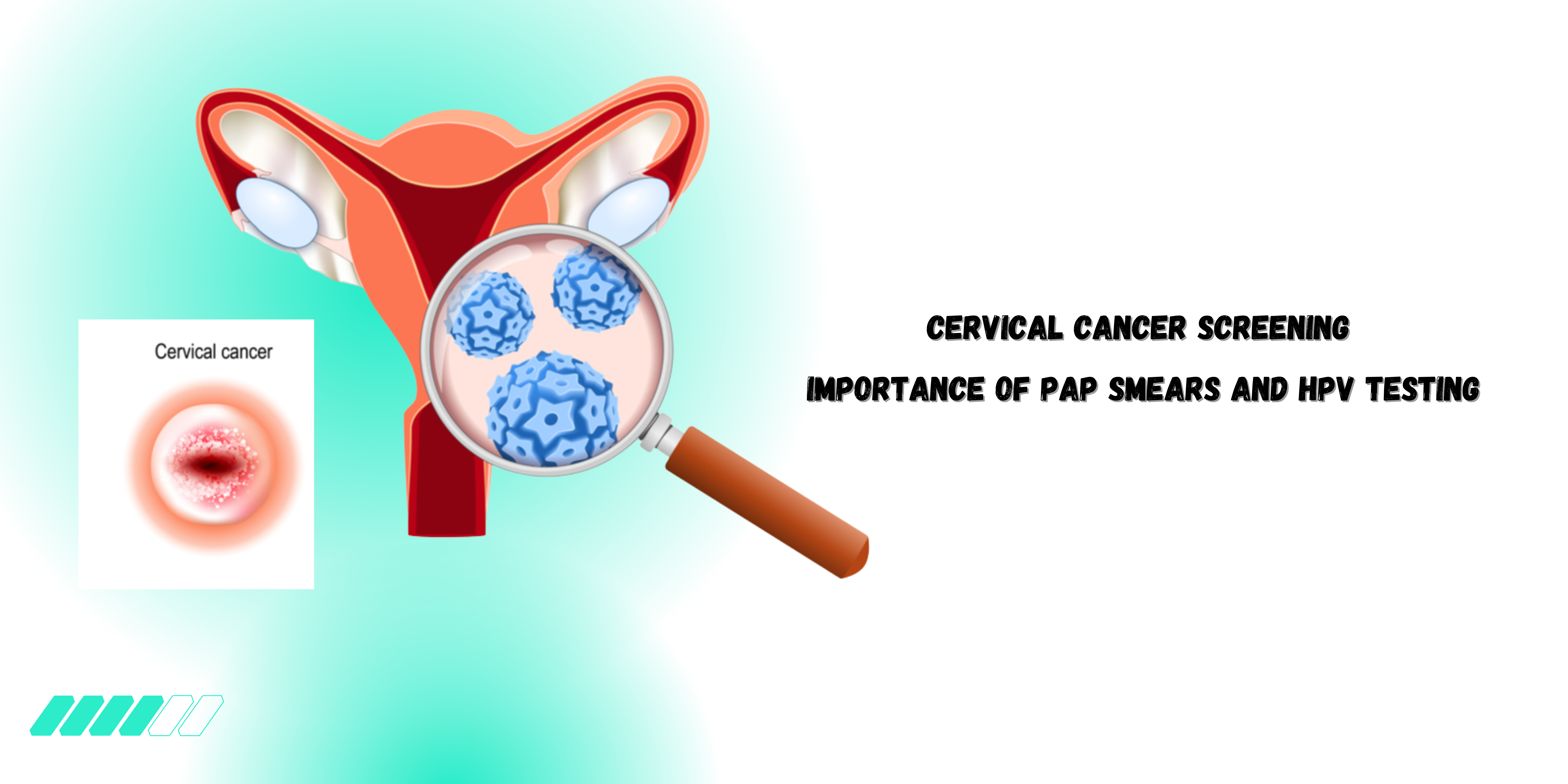 Cervical Cancer Screening Importance of Pap Smears and HPV Testing