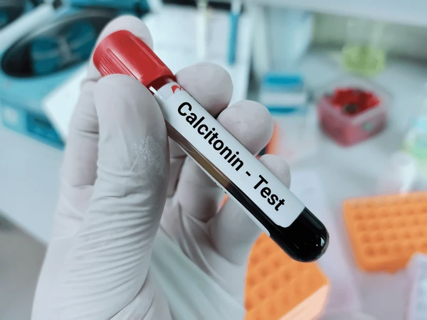 Calcitonin test