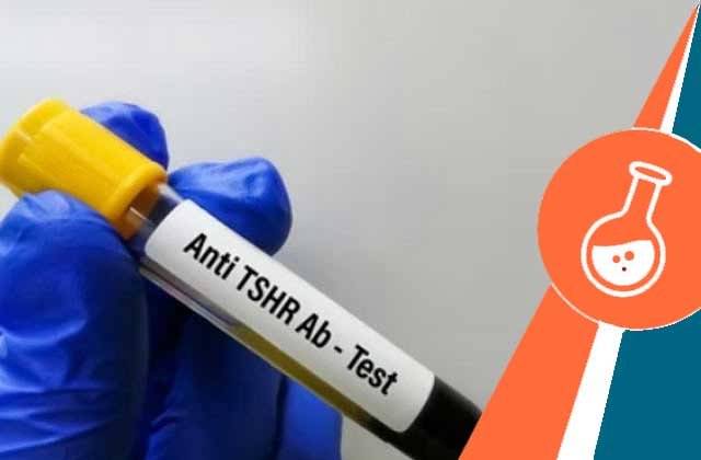 tsh receptor antibody test