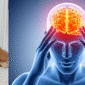 headache and migraines