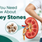 kidney stones
