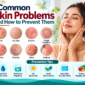 Common Skin Problems Prevention