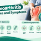 Osteoarthritis Causes and Symptoms